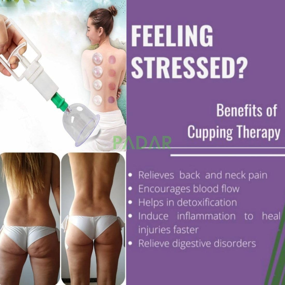 12 Cups Vacuum Cupping Device