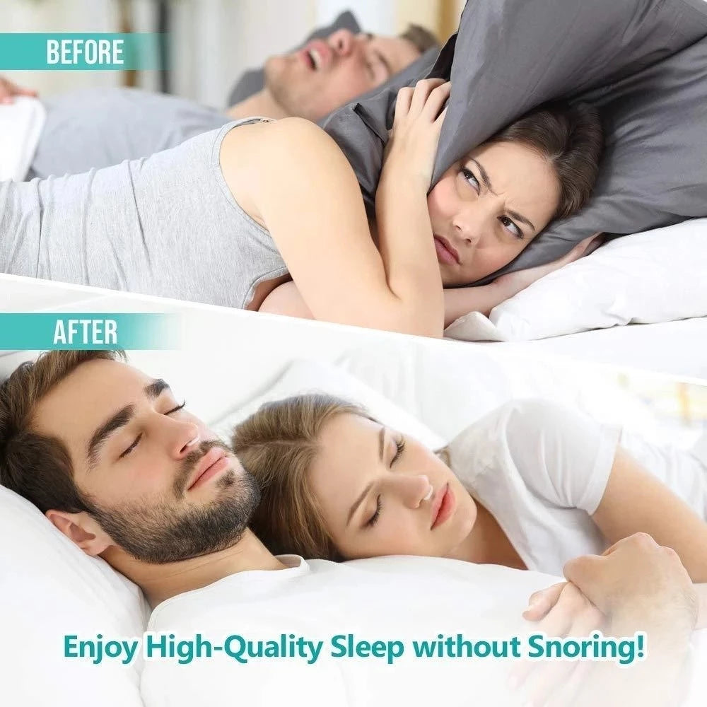 Anti-snoring Magnetic Nose Clip
