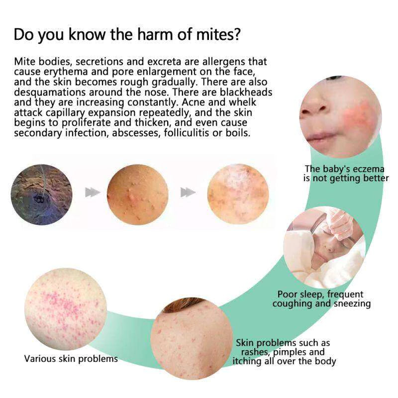 BUY 1 GET 1 | Bed Bug & Mite Killer Spray 300ml